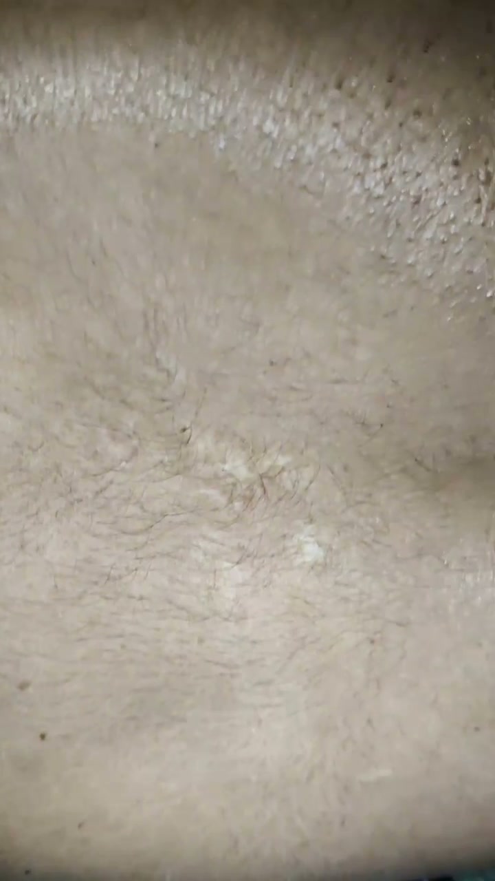 Frame 10