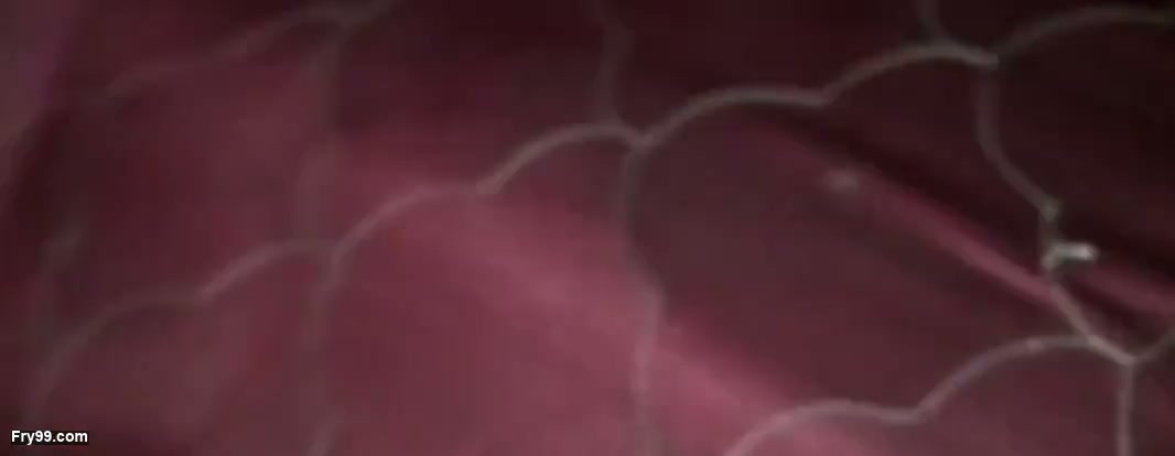 Frame 6