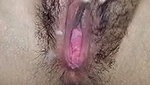 The vaginal chip is leaking out of the fluid