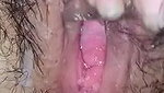 The vaginal chip is leaking out of the fluid