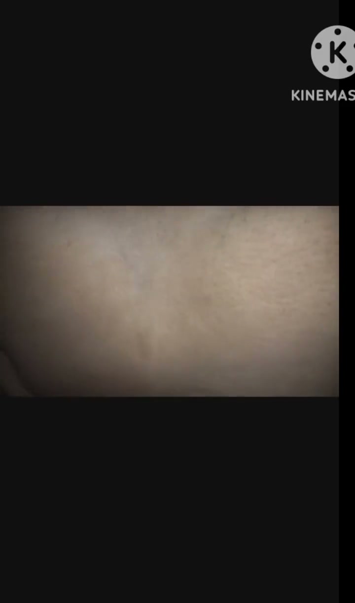 Frame 7