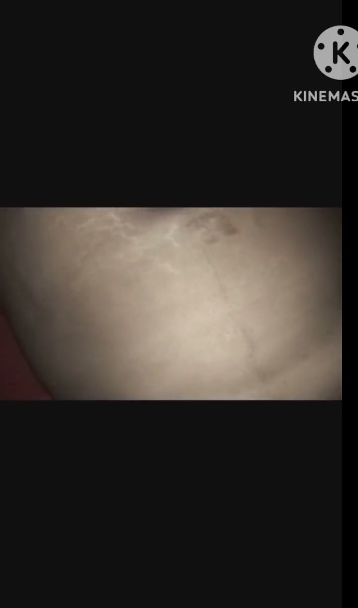 Frame 9