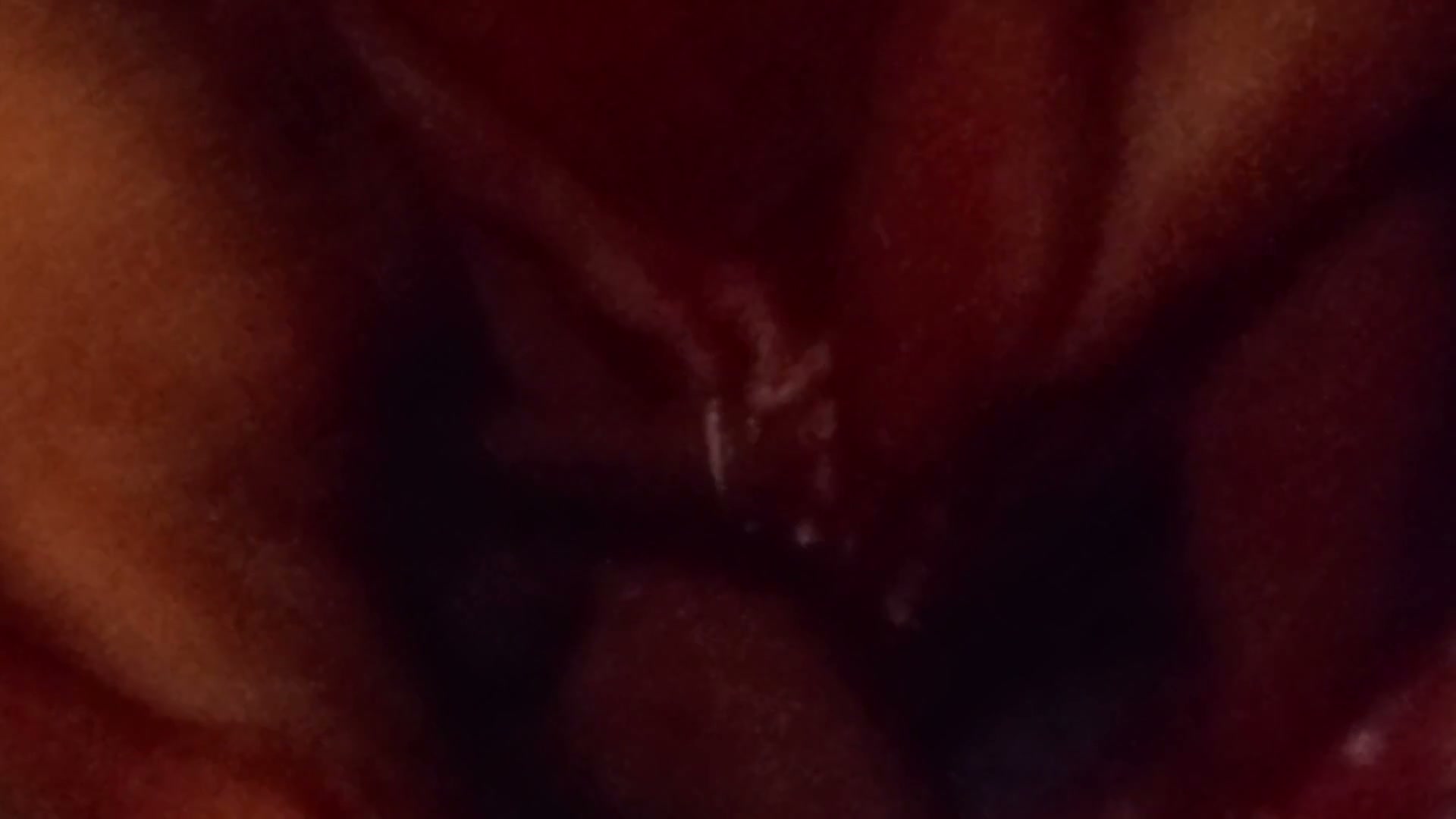 Frame 1