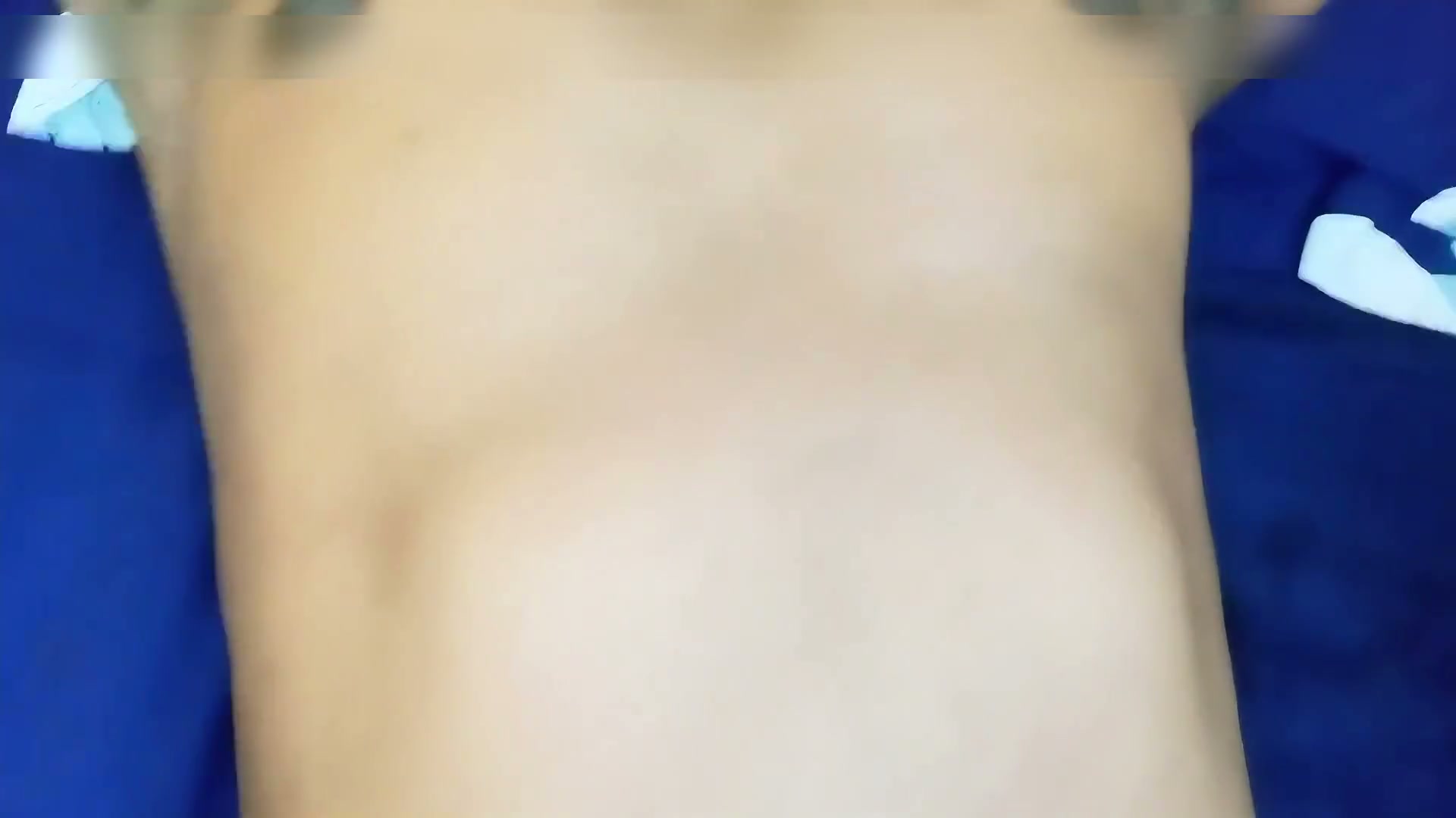 Frame 6