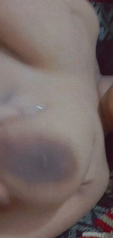 G__3_1