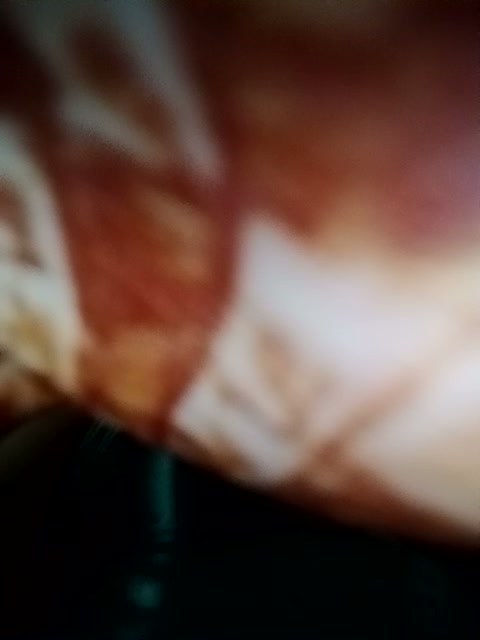 Frame 6