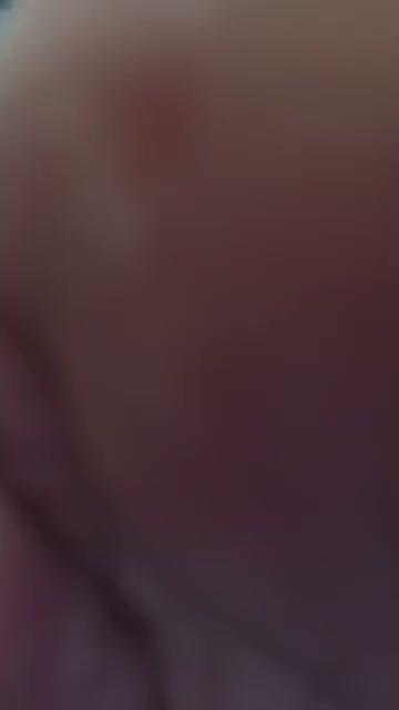 Frame 6