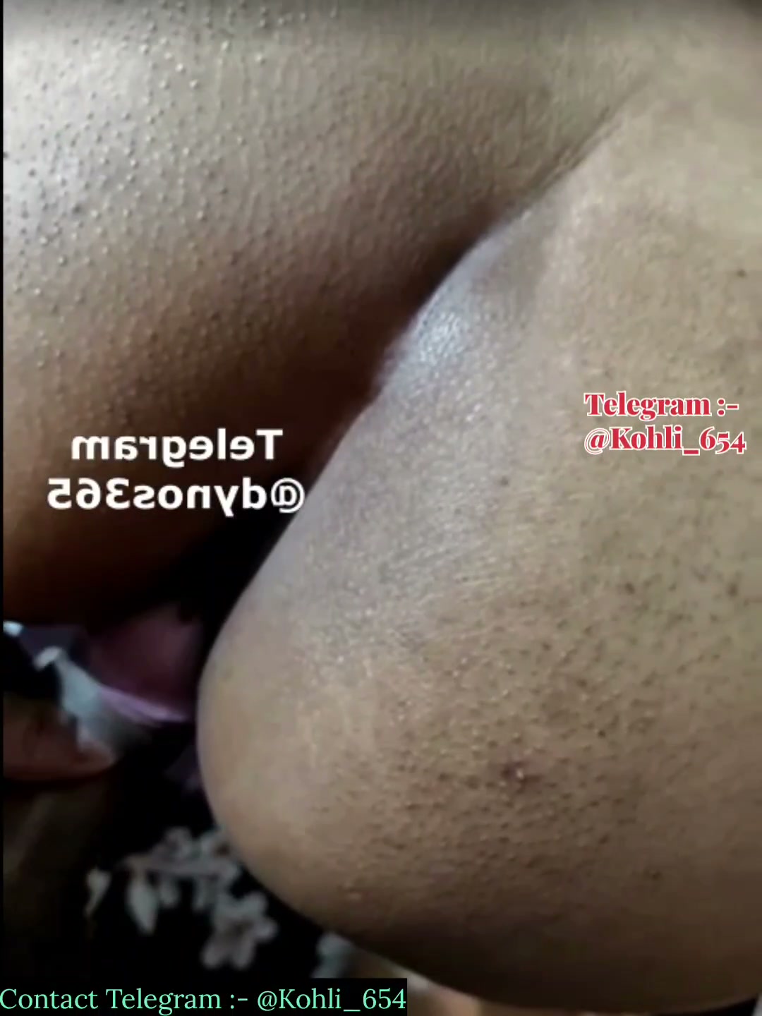 Frame 6