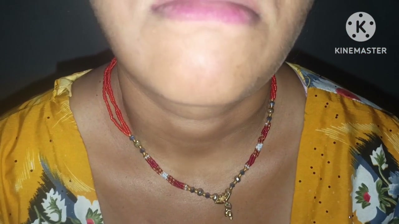 Frame 1