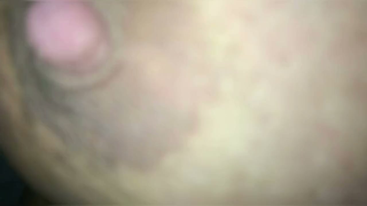 Frame 1