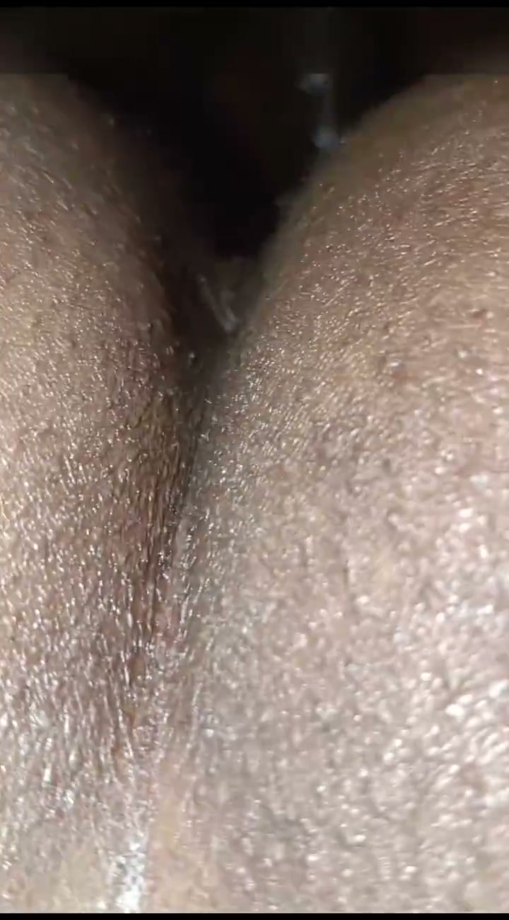 Frame 6