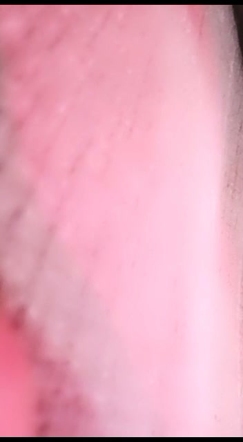 Frame 7
