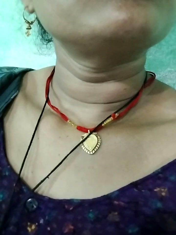 Frame 7