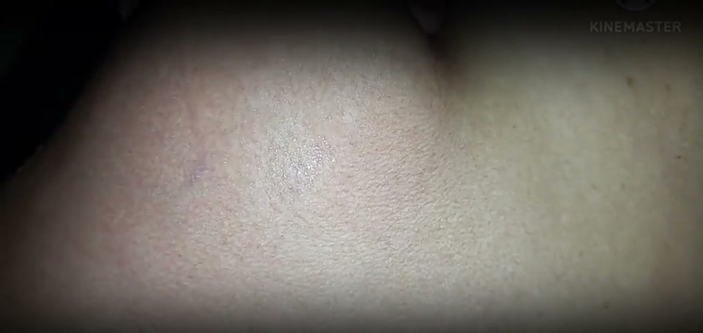 Frame 10