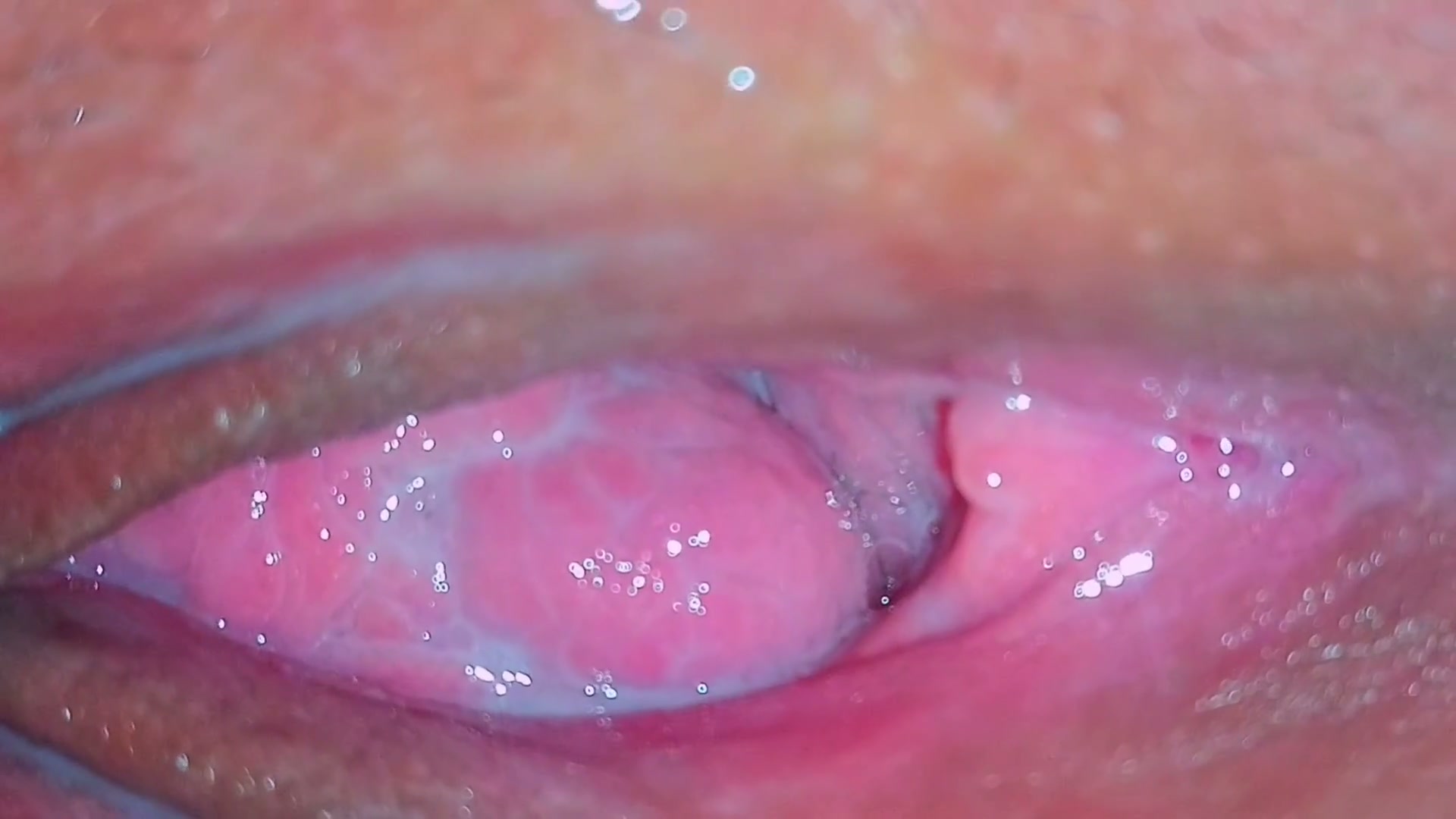 Frame 9