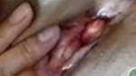 Continuation of jerking with assy