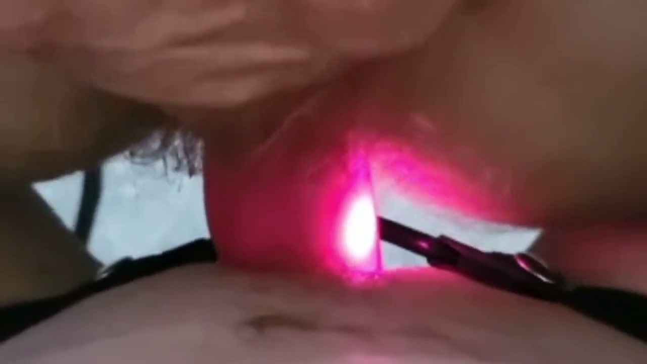 Frame 8