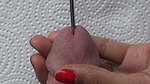 What did she Put in my Dick Hole first Time Sounding Session with my Hot Doctor