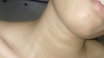An 18-year-old girl is having a hard time getting pregnant