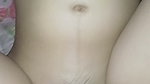 An 18-year-old girl is having a hard time getting pregnant