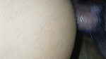 An 18-year-old girl is having a hard time getting pregnant