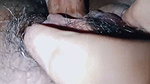 Breast leg abg