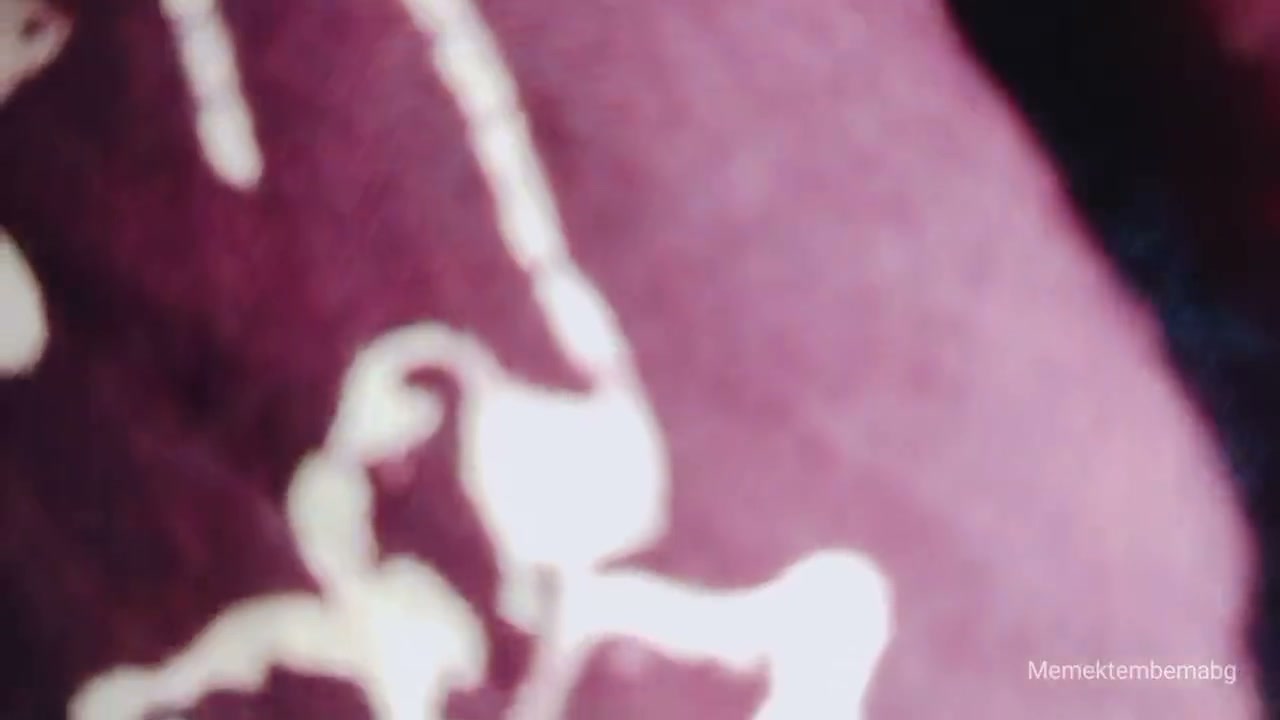 Frame 8
