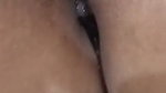Sounding and pee
