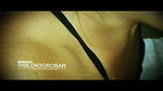 Huge Booty Colombian Albino Midget