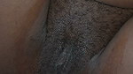 Injured Arm Black Midget, Takes Big White Cock