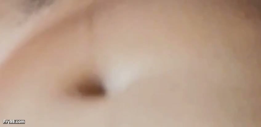 Frame 10