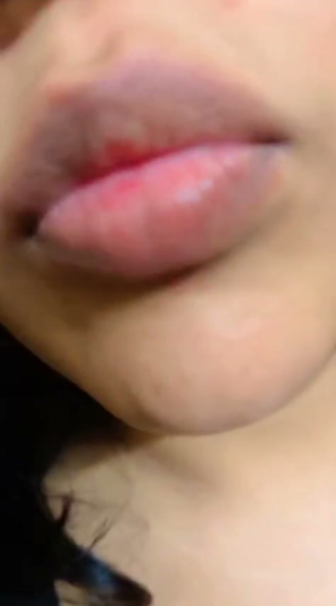 Frame 10