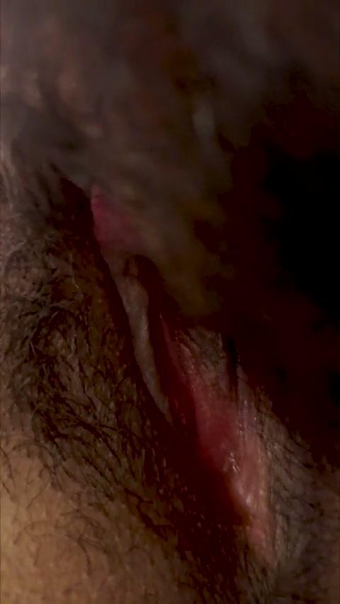 Frame 5