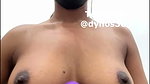 ThyroidLancers Stripchat ticket show