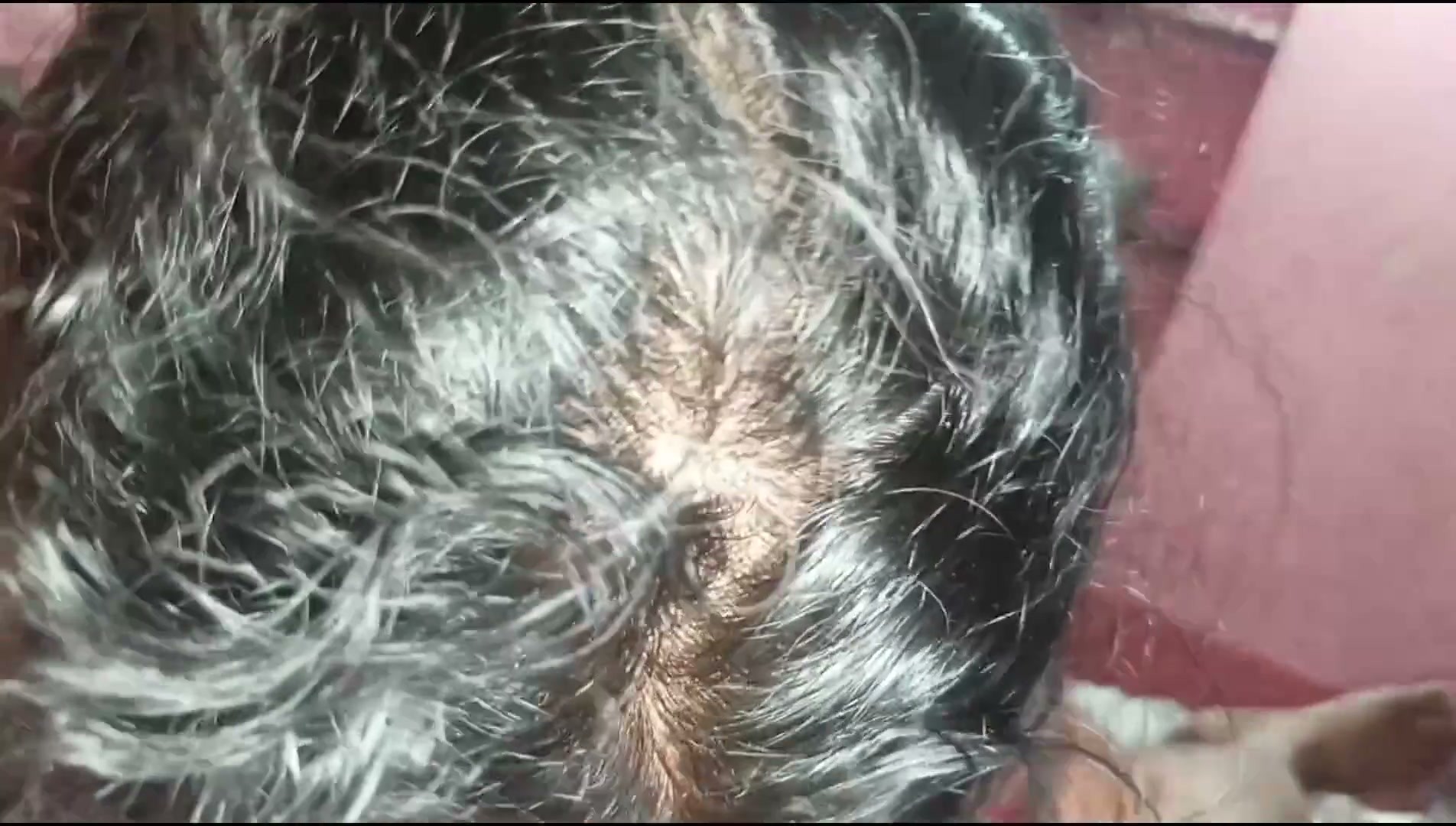 Frame 1