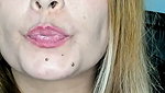 Endoscopy!! Giantess Swallowed a 25 Members at Same Time
