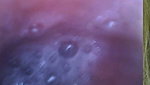 Endoscopy!! Giantess Swallowed a 25 Members at Same Time