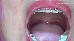 Swallowing and Playing with Big Plastic Bears