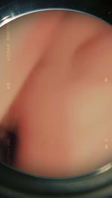 Frame 3