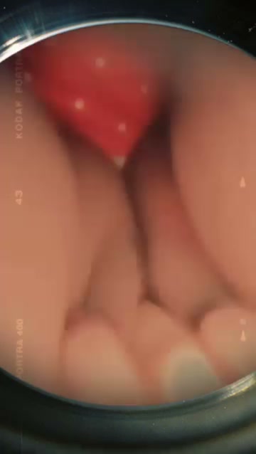 Frame 6