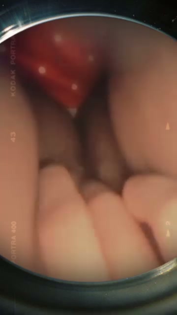 Frame 8