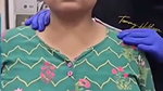 Huge Breast of desi lady’s squeezed by doctor (2) 2