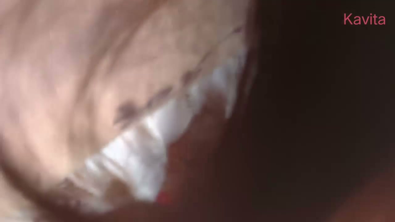 Frame 2