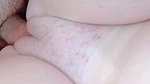 My dick gave her an allergic reaction in her pussy