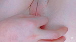 peeling off her very close lips with white discharge between them