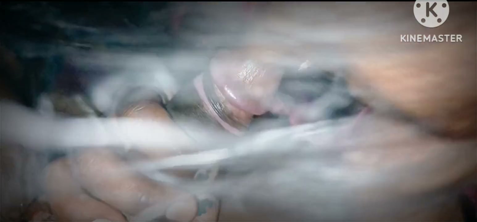 Frame 2