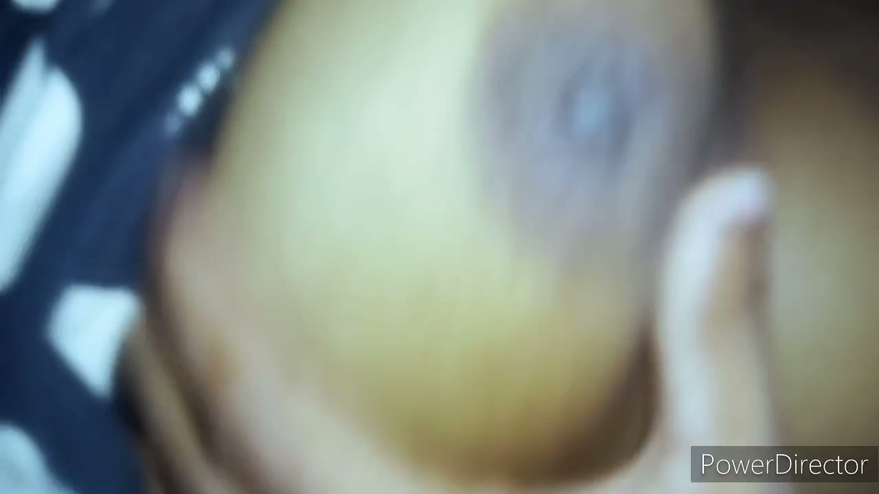 Frame 2