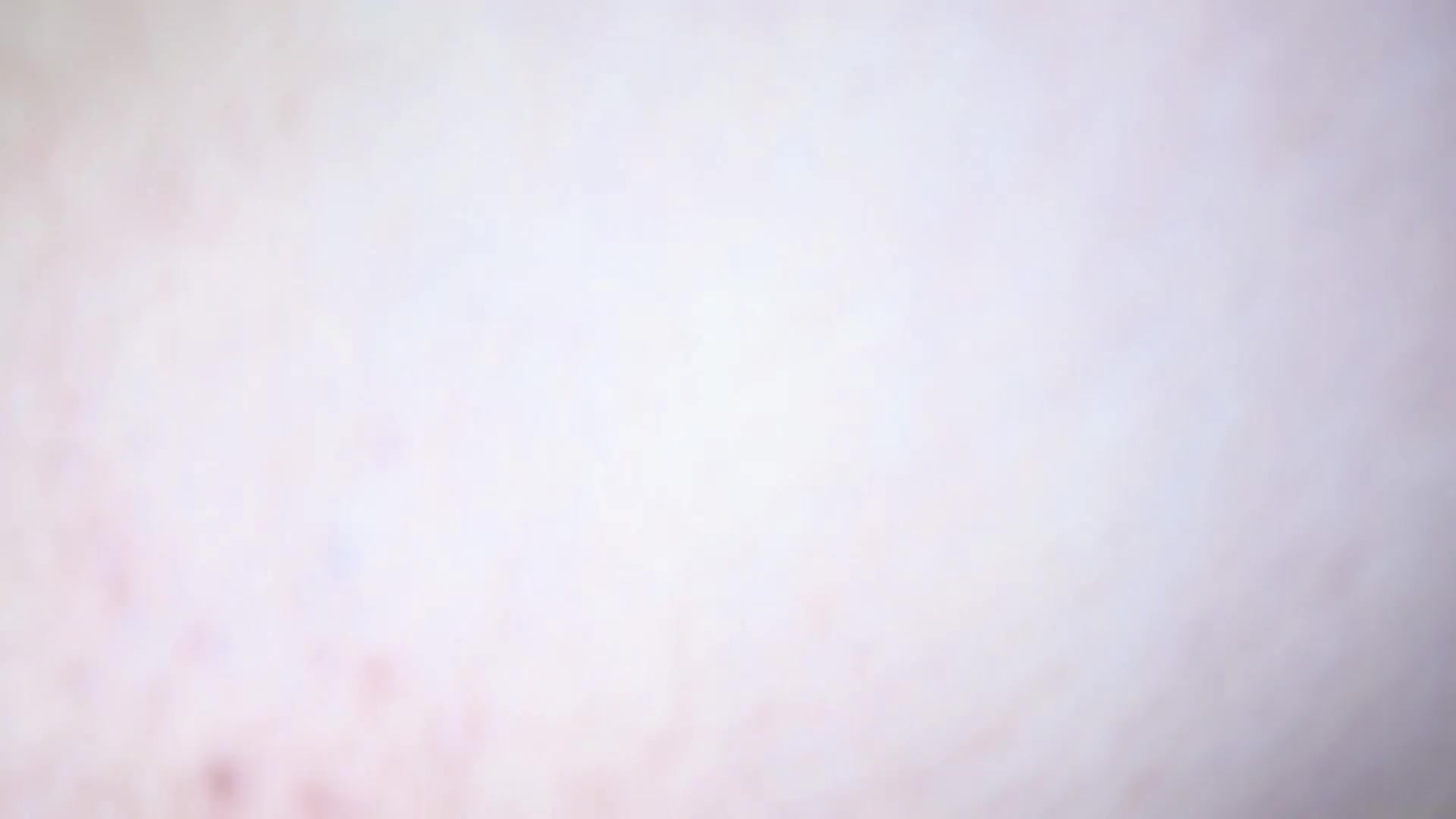 Frame 9