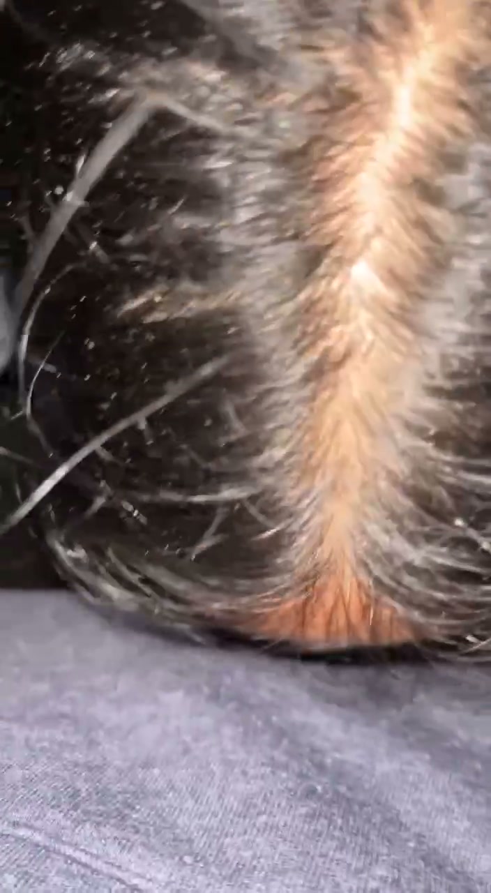 Frame 1