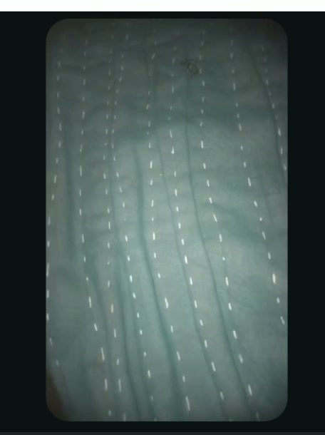 Frame 1